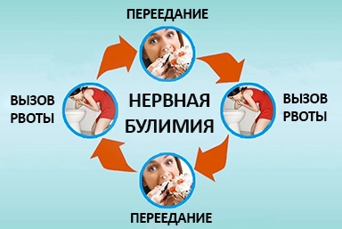 Лечение булимии в Лесосибирске